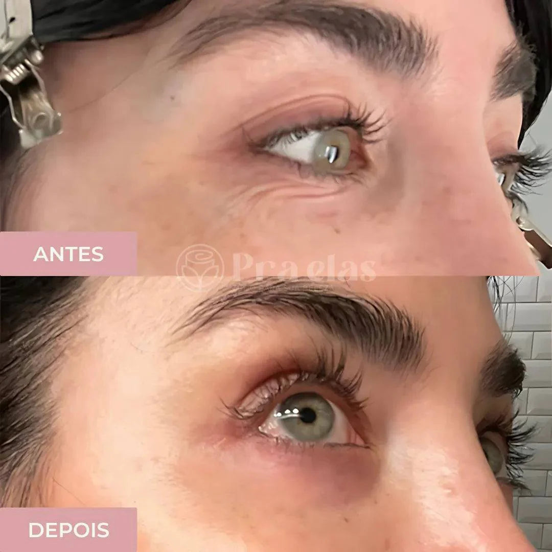 Crema Antiarrugas Instantánea - (12 Horas de Duración) ® + Regalo