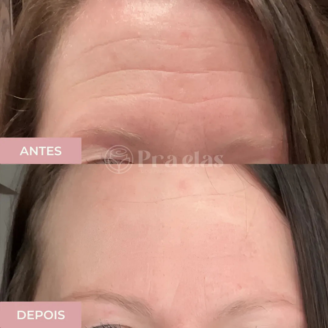 Crema Antiarrugas Instantánea - (12 Horas de Duración) ® + Regalo