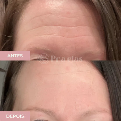 Crema Antiarrugas Instantánea - (12 Horas de Duración) ® + Regalo