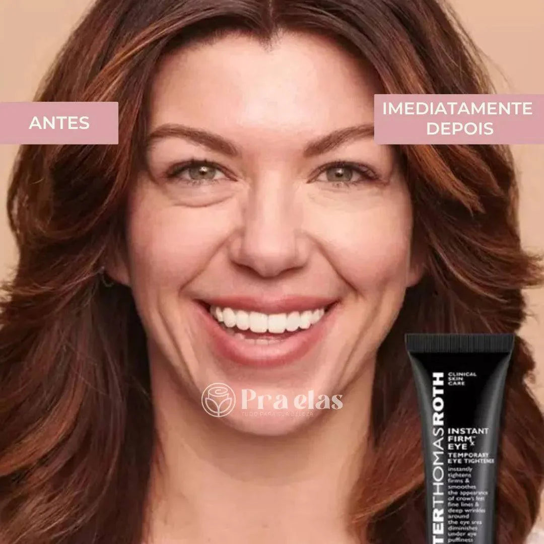 Crema Antiarrugas Instantánea - (12 Horas de Duración) ® + Regalo