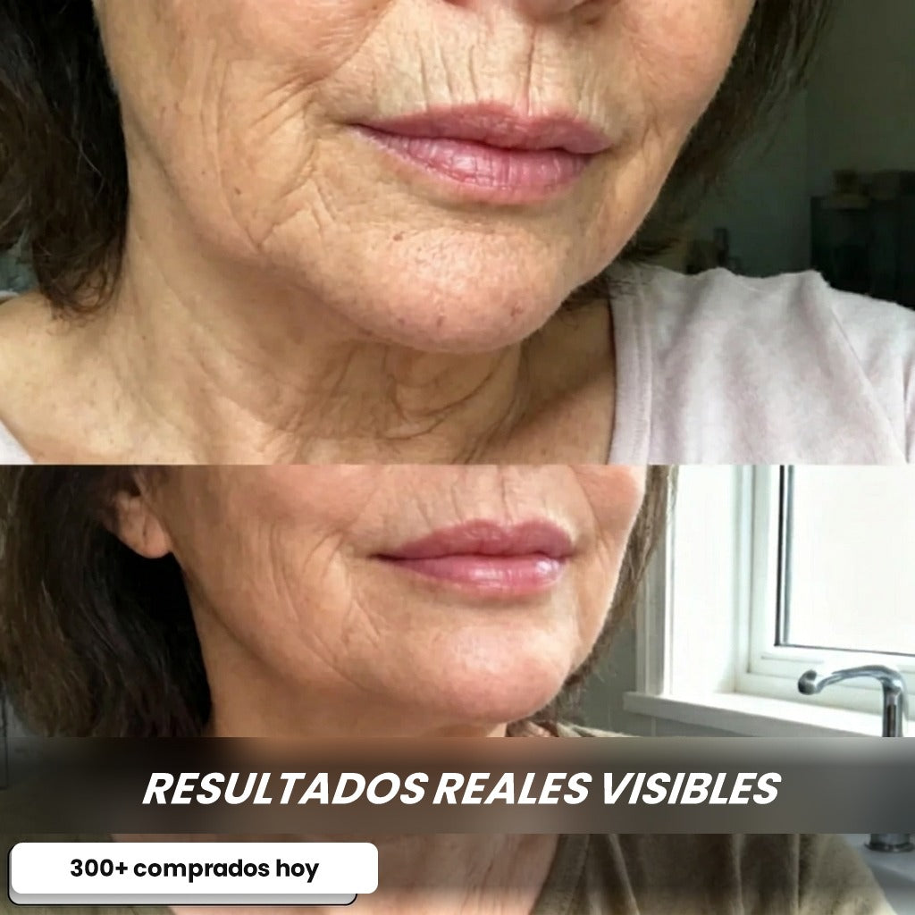 Antes y después en el contorno de la boca y el cuello